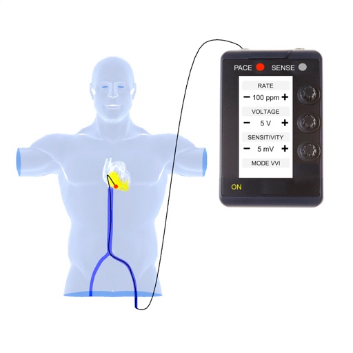 Temporary Cardiac Pacing For Pc Windows