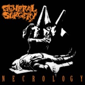 General Surgery - Severe Catatonia In Pathology