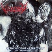 Vulvectomy - Fornicate in Putrefaction