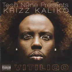 Vitiligo - Krizz Kaliko Vitiligo - Krizz Kaliko