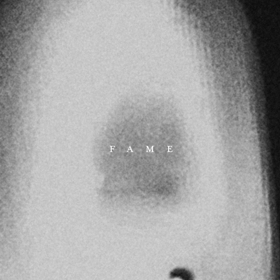 Cover artwork for Fame (Jesse Rose Mix)