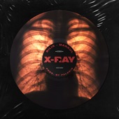 X-Ray artwork
