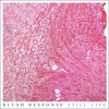 Still Life - Single