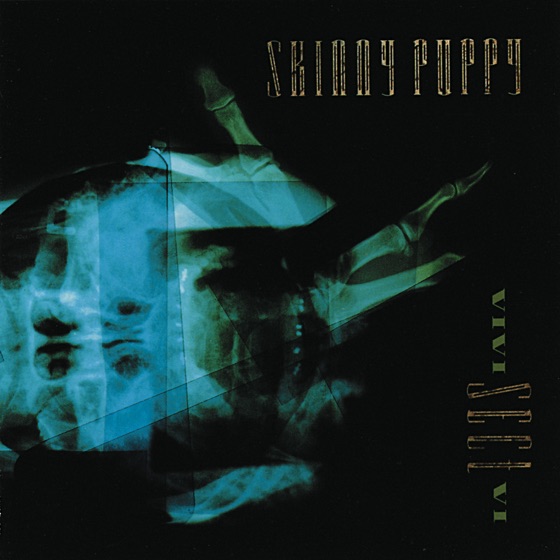 Cover artwork for State Aid