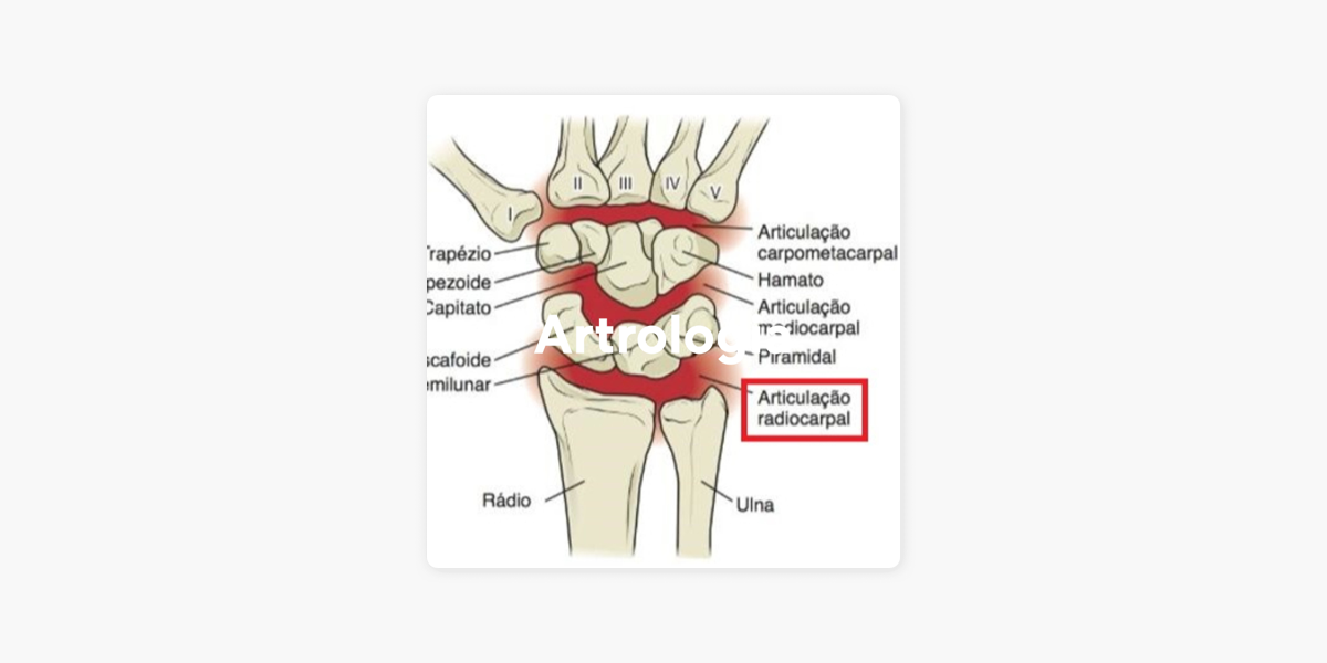 Artrologia Articula O Do Punho Ou Radiocarpal On Apple Podcasts