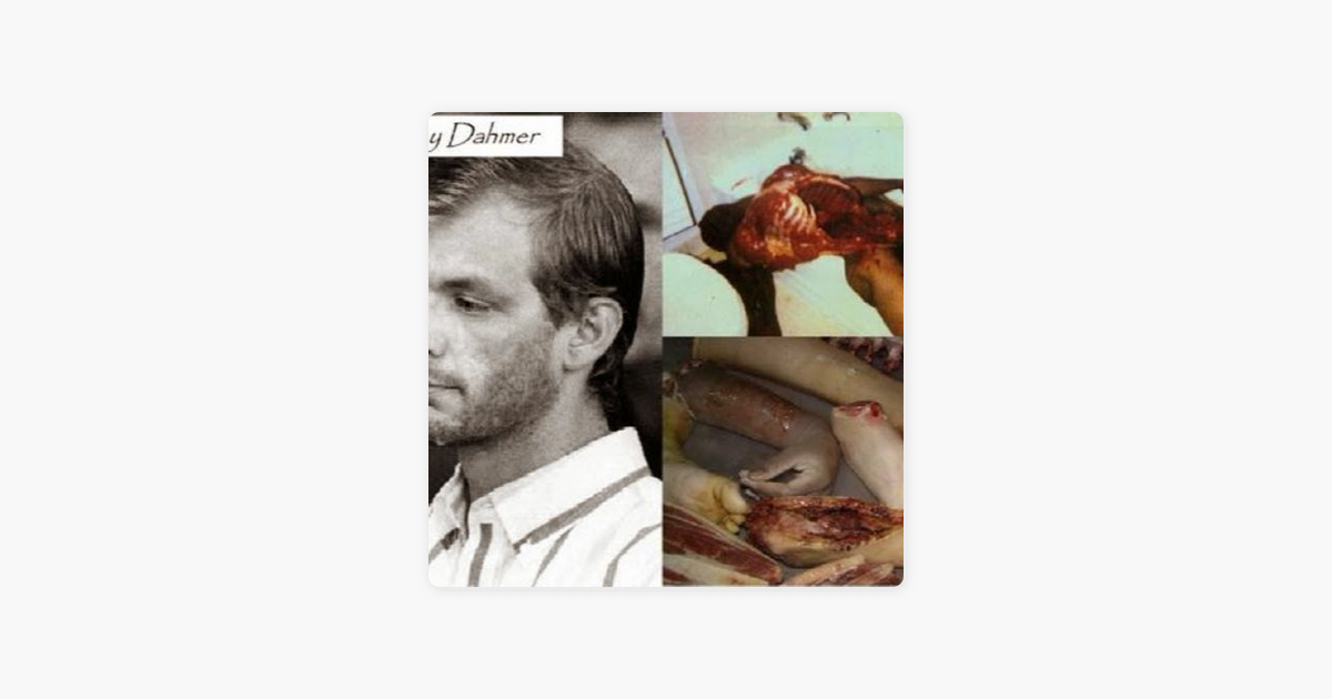 Jeffrey Dahmer Autopsy Photos