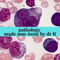 OsteoPetrosis Pathology