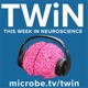 TWiN 51: Sensory processing dysfunction in autism spectrum disorders