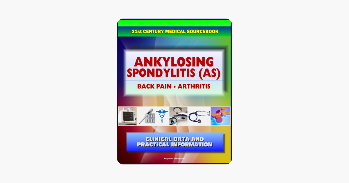 21st Century Ankylosing Spondylitis As Sourcebook - 