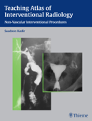 Teaching Atlas of Interventional Radiology - Saadoon Kadir