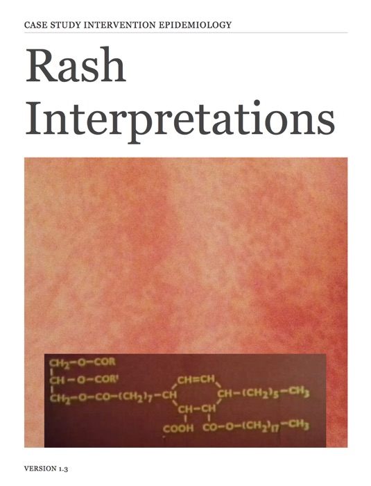 Rash Interpretations