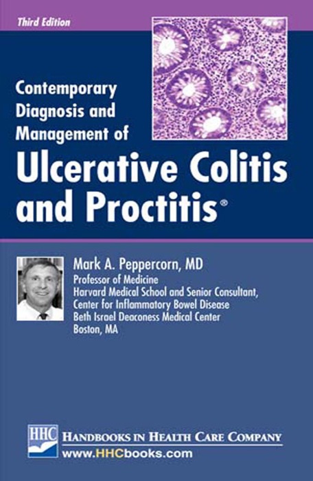 Contemporary Diagnosis and Management of Ulcerative Colitis and Proctitis®, 3rd edition