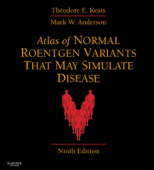 Atlas of Normal Roentgen Variants That May Simulate Disease E-Book - Mark W. Anderson MD & Theodore E. Keats MD