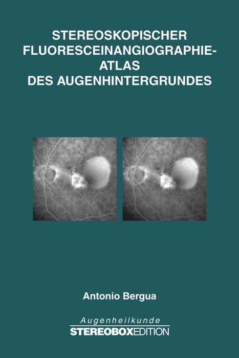 Stereoskopischer  Fluoresceinangiographie-Atlas  des Augenhintergrundes