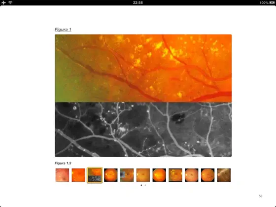 Screenshot 3 Condutas em retina - EPM / UNIFESP iphone
