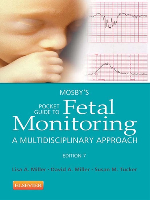 Mosby's Pocket Guide to Fetal Monitoring - E-Book