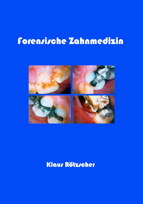 Forensische Zahnmedizin