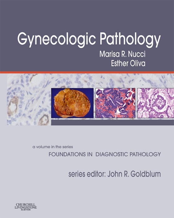 Gynecologic Pathology E-Book