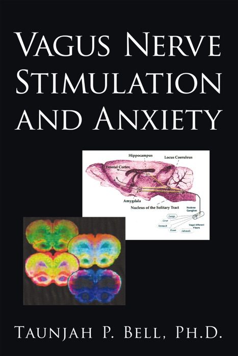 Vagus Nerve Stimulation and Anxiety