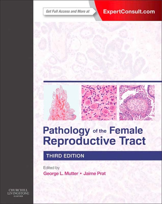 Pathology of the Female Reproductive Tract E-Book