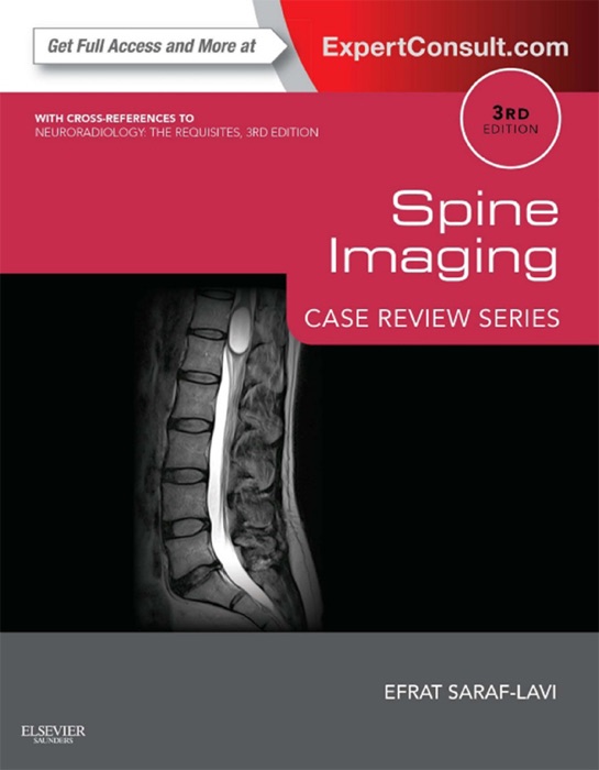 Spine Imaging E-Book