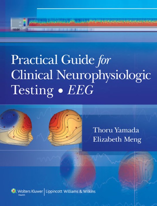 Practical Guide for Clinical Neurophysiologic Testing: EEG