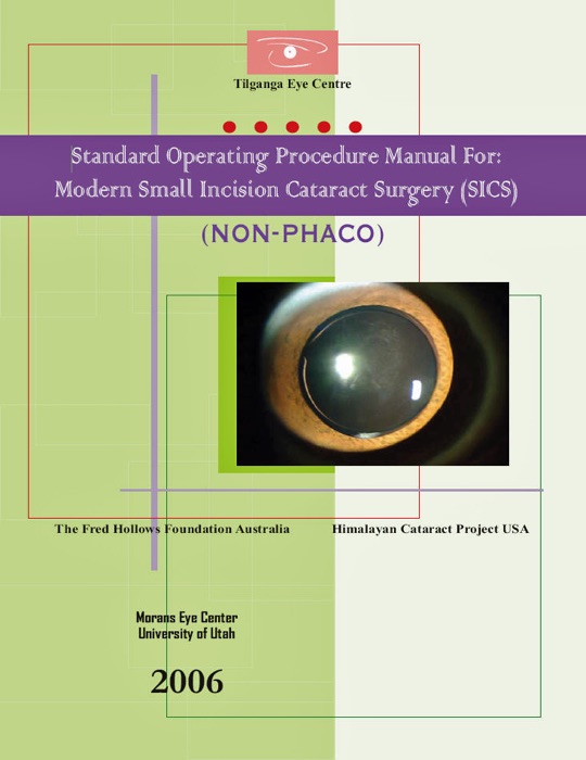 Standard Operating Procedure Manual For: Modern Small Incision Cataract Surgery