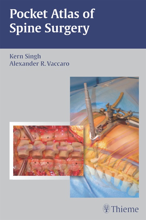 Pocket Atlas of Spine Surgery