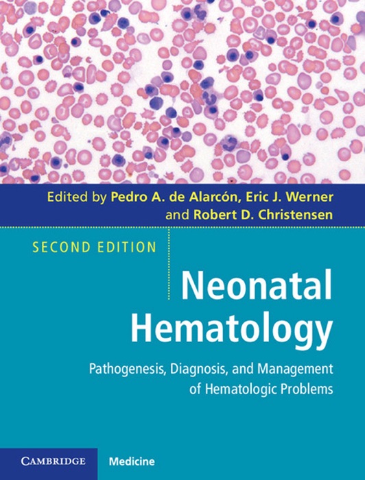 Neonatal Hematology: Second Edition