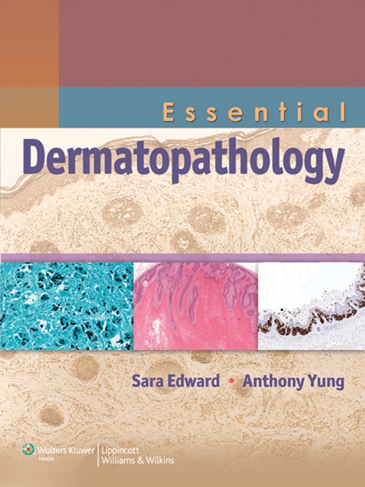 Essential Dermatopathology