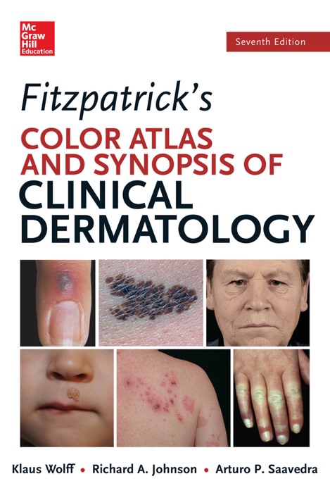 Fitzpatrick's Color Atlas and Synopsis of Clinical Dermatology, Seventh Edition