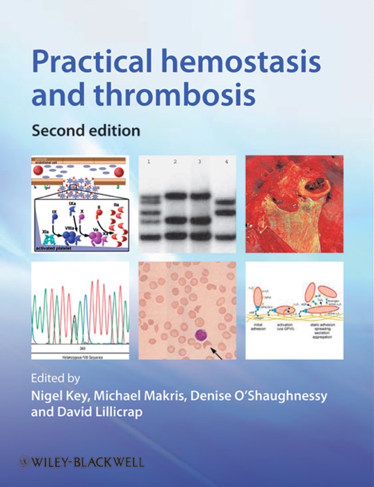 Practical Hemostasis and Thrombosis