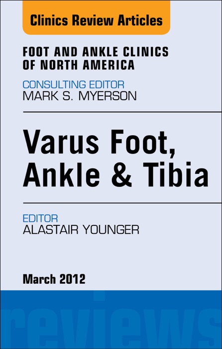 Varus Foot, Ankle, and Tibia