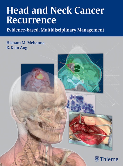 Head and Neck Cancer Recurrence