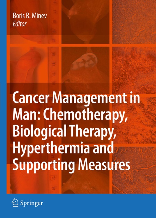 Cancer Management in Man: Chemotherapy, Biological Therapy, Hyperthermia and Supporting Measures