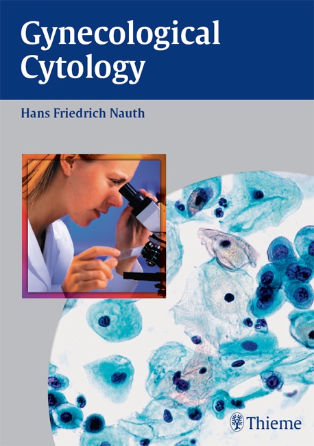 Gynecologic Cytology