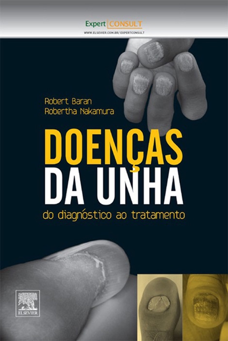 Doenças da Unha