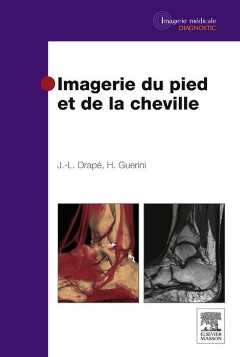 Imagerie du pied et de la cheville