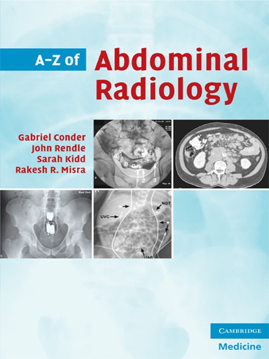 A-Z of Abdominal Radiology