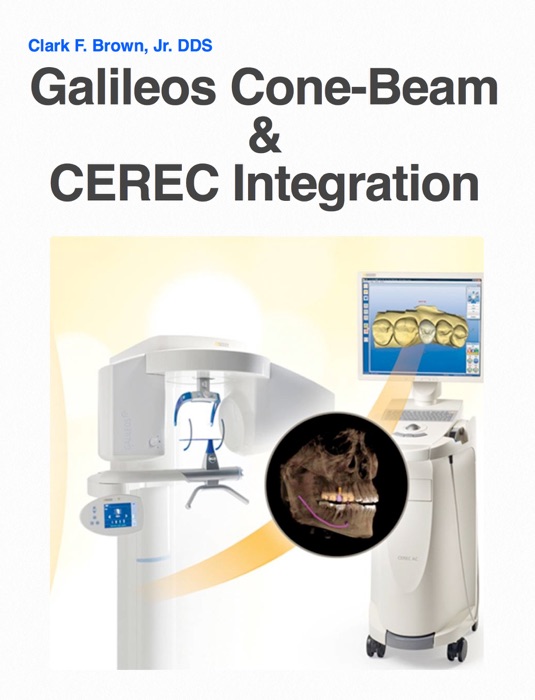 Galileos Cone-Beam & CEREC Integration