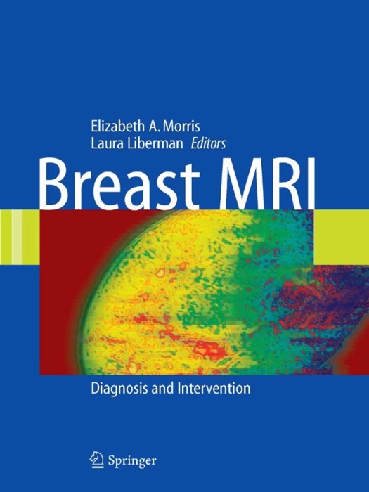 Breast MRI