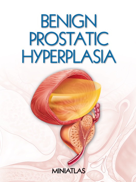 Benign Prostatic Hyperplasia Miniatlas