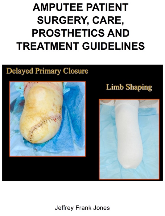 AMPUTEE PATIENT SURGERY, CARE, PROSTHETICS AND TREATMENT GUIDELINES