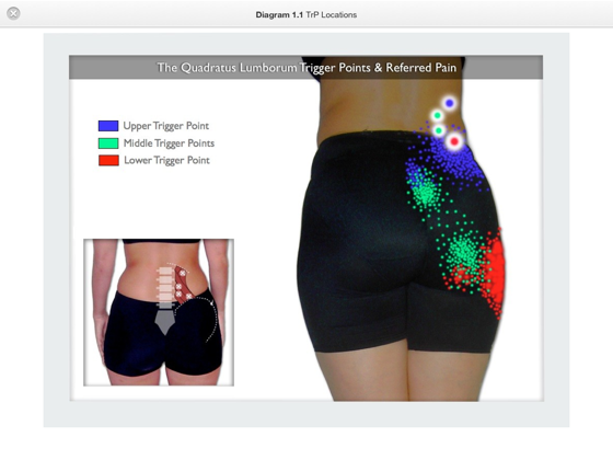 ‎Trigger Point Therapy for the Quadratus Lumborum on Apple Books