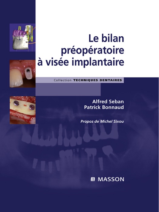 Le bilan préopératoire à visée implantaire