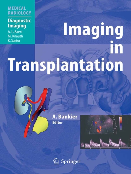 Imaging in Transplantation