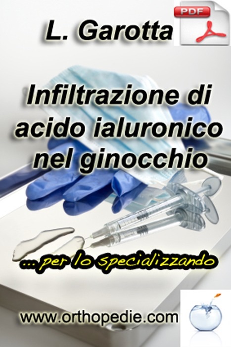 Infiltrazione di acido ialuronico nel ginocchio... per lo specializzando