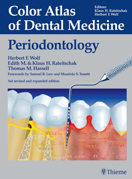 Color Atlas of Dental Medicine: Periodontology