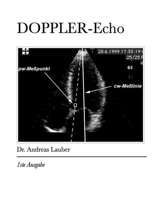 Doppler-Echokardiographie