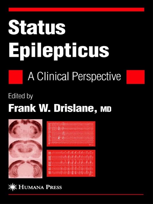 Status Epilepticus